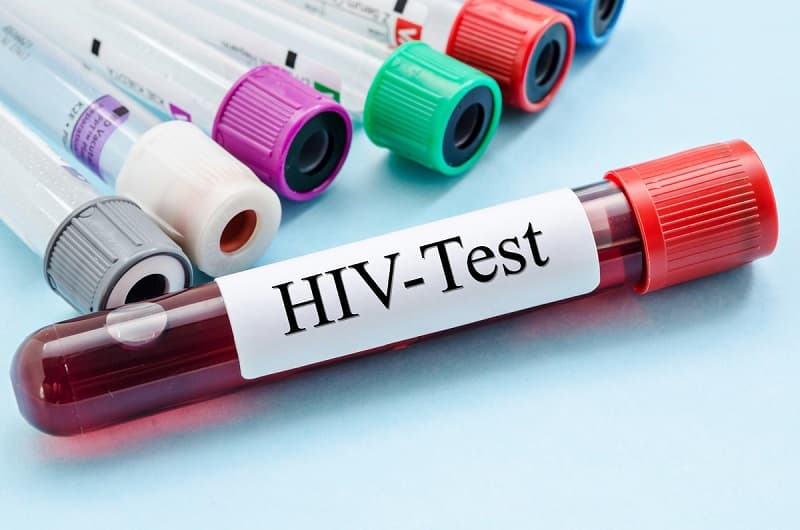 Besplatno i anonimno testiranje na HIV