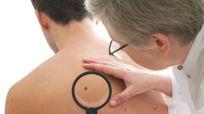 Besplatni pregledi za prevenciju raka kože i u Čačku, Užicu, Požegi...
