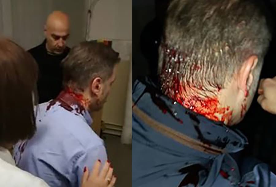 MUP: Uhapšeni napadači na Borka Stefanovića
