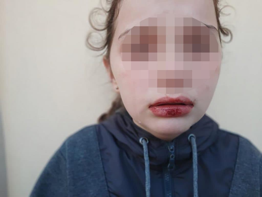 Devojčicu iz Čačka (10) pretukle vršnjakinje u parku