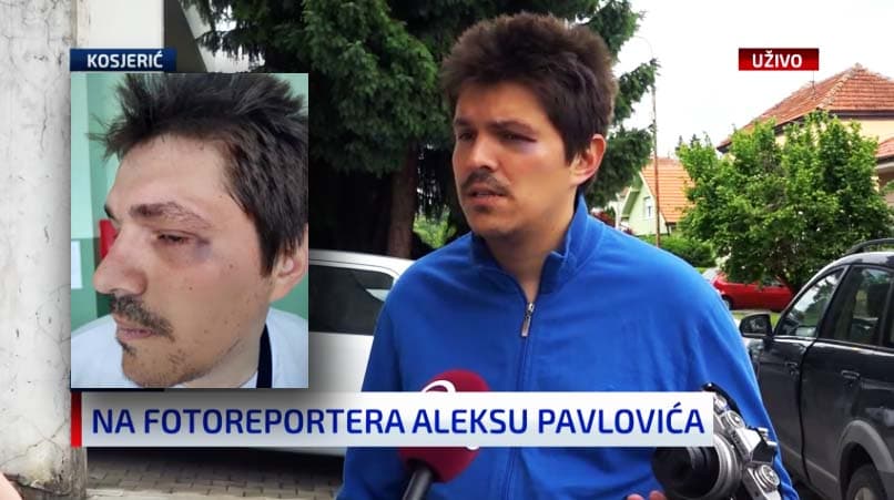Povređeni aktivista iz Kosjerića: Nadam se da će tužilaštvo ovog puta odrediti pritvor napadaču
